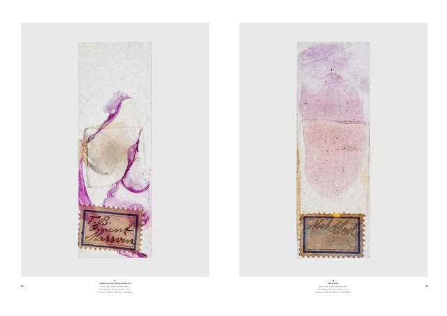 (L) TUBERCULOSIS FROM GUINEA PIG (R) MY BLOOD Microscopic slides from a glass plate. Photo By Nicolai Howalt, 2020. Courtesy of Medical Museion, Copenhagen.